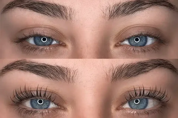 Eyebrow and Eyelash Lifting + Botox